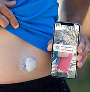 What Is The Best Blood Glucose Monitor? - The Guardian Connect System